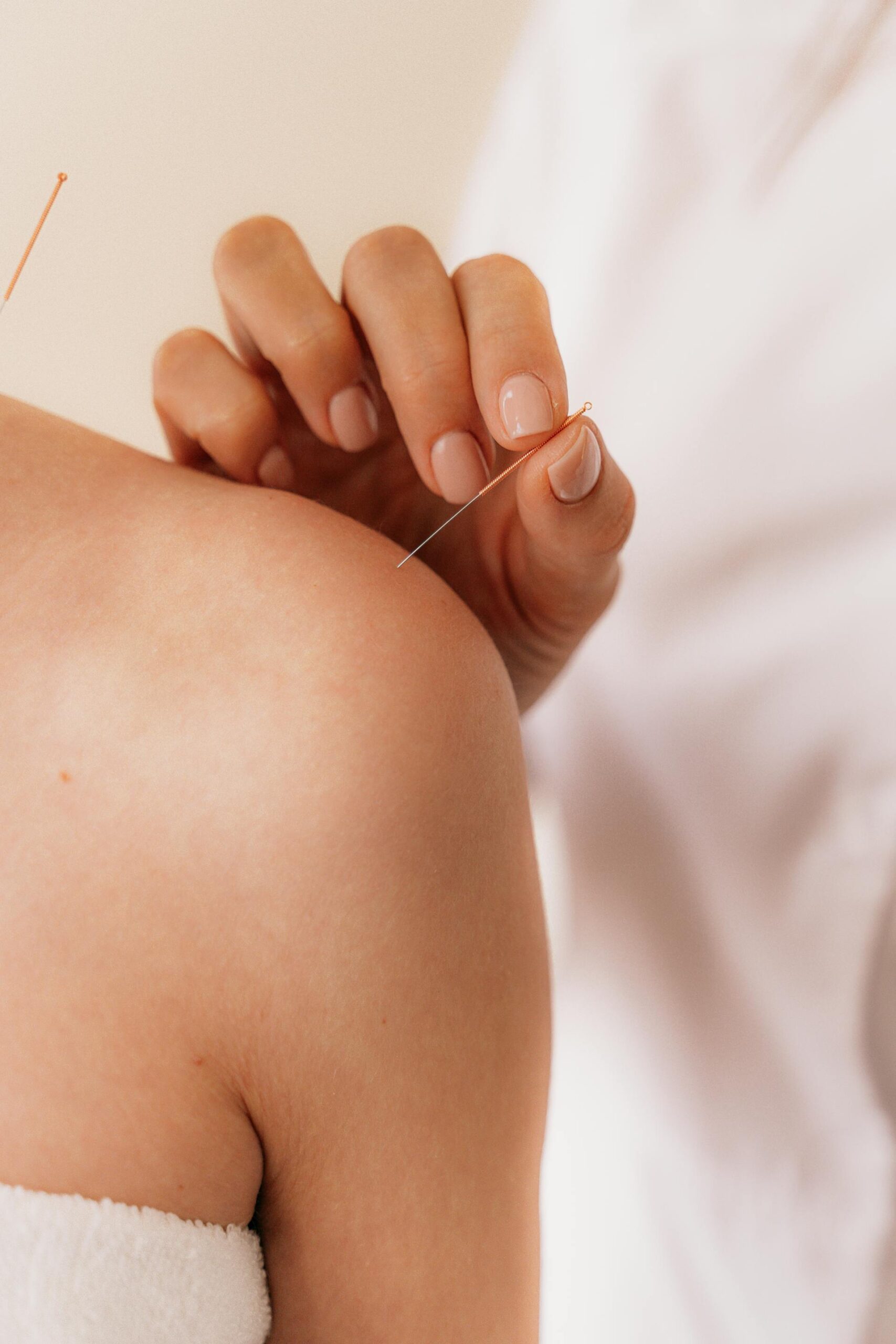 Daisy Freedman Acupuncture, traditional acupuncture in the Forest of Dean, chronic pain, emotional health, womens wellbeing, fire cupping, help with digestive issues, facial enhancement acupuncture