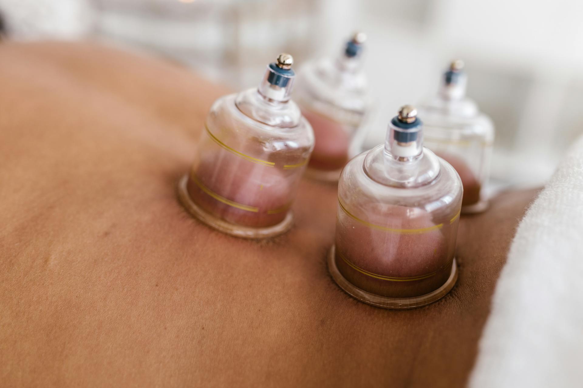 Daisy Freedman Acupuncture, traditional acupuncture in the Forest of Dean, chronic pain, emotional health, womens wellbeing, fire cupping, help with digestive issues, facial enhancement acupuncture